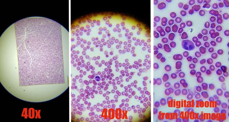 Viewing Blood Under The Microscope