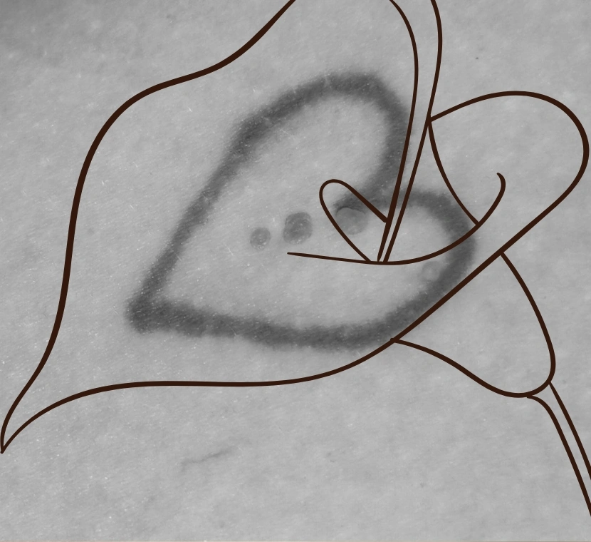 29 (4)