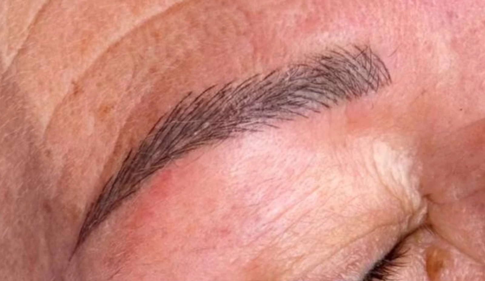 35 (5)