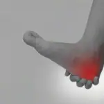 かかとの痛み