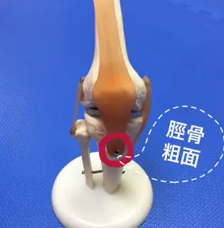 オスグッド