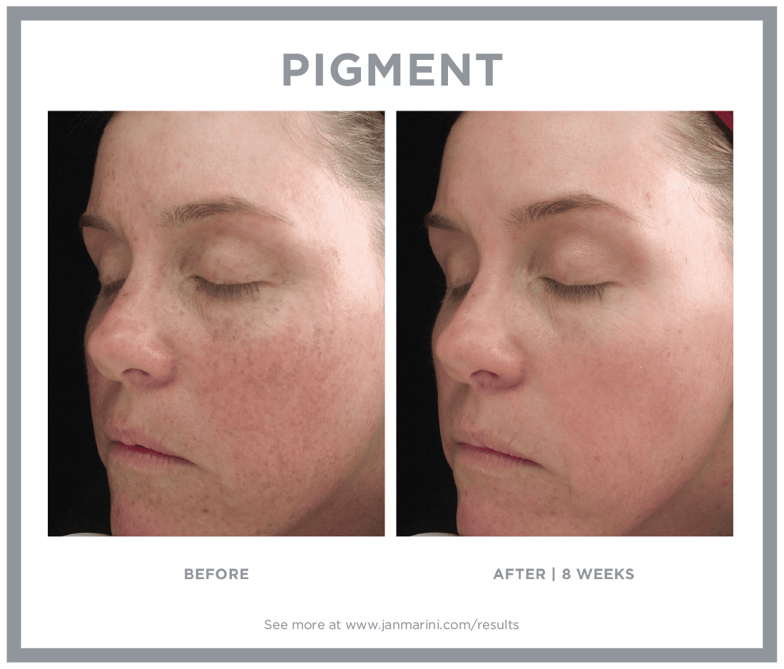 Jan Marini B&A 1