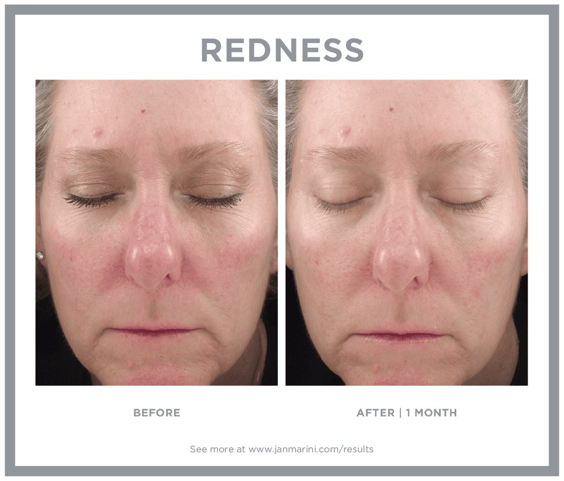 Jan Marini B&A 3