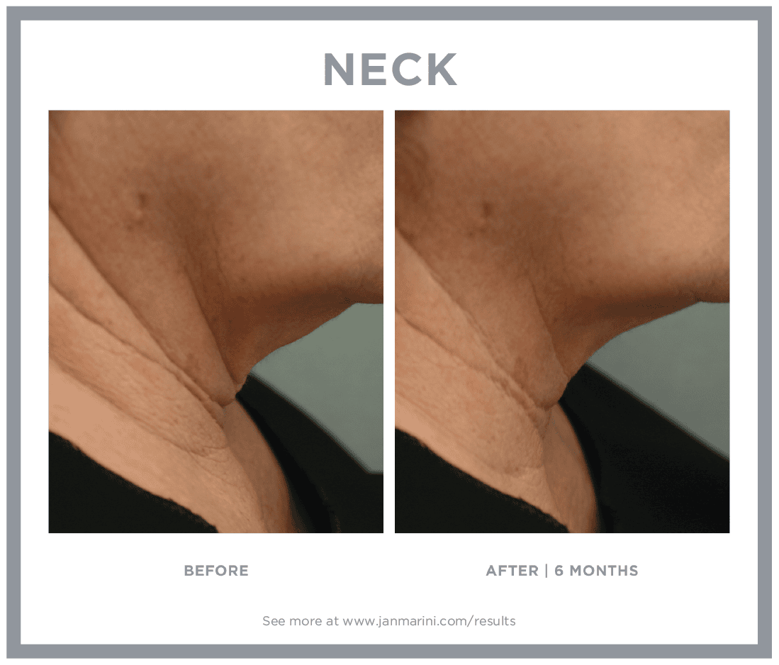 Jan Marini B&A 4