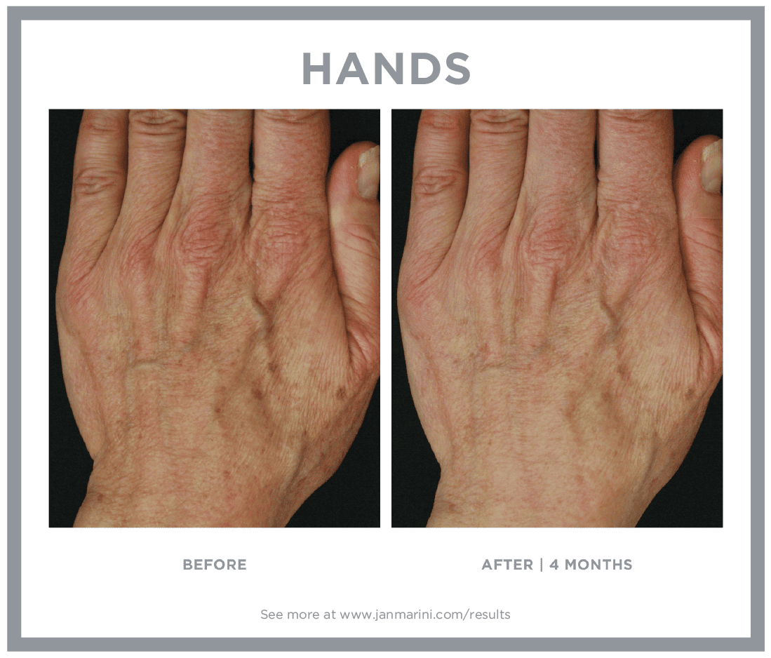 Jan Marini B&A 5