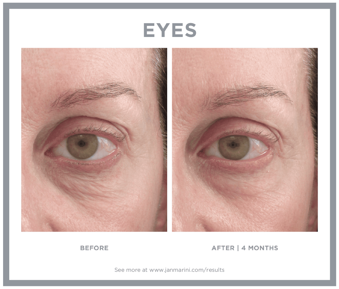 Jan Marini B&A 6