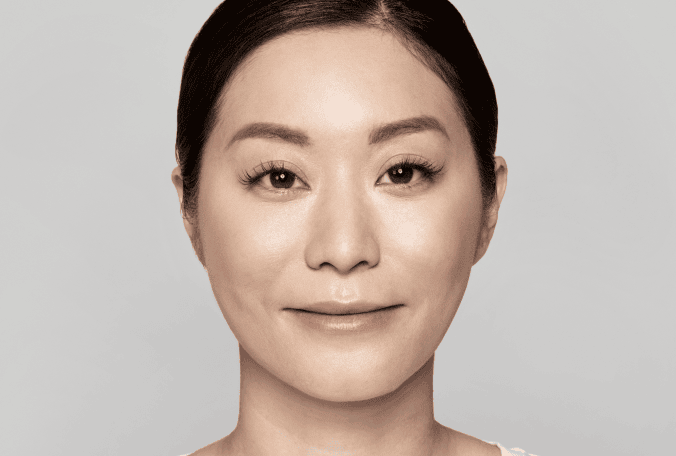 Womans face after treatment with Restylane Silk