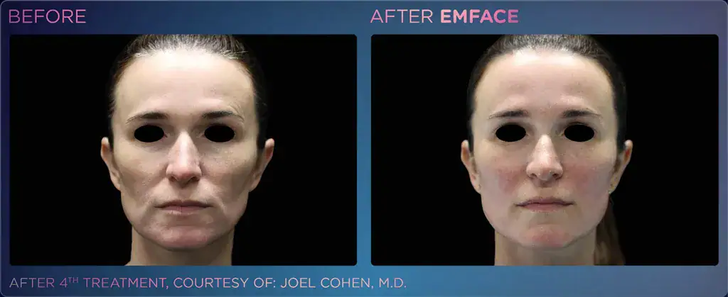 Julene Samules - EMFACE