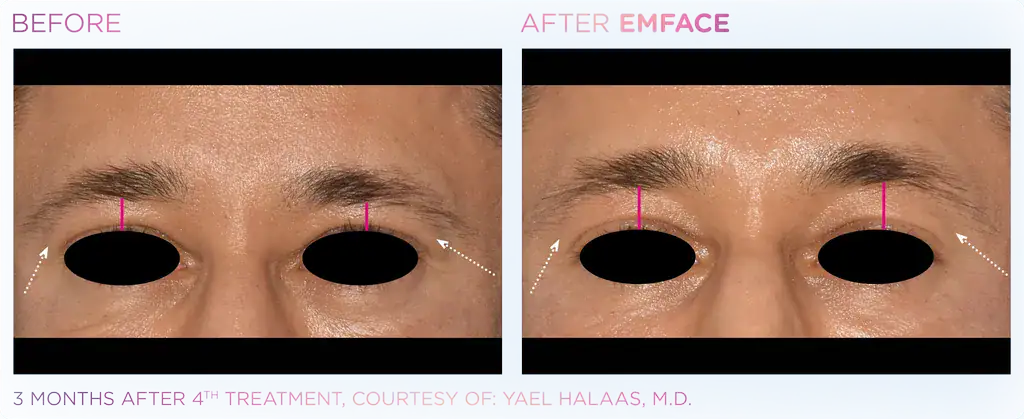 Julene Samules - EMFACE_2