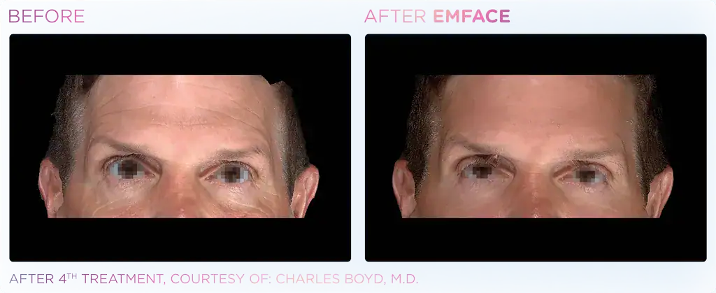 Julene Samules - EMFACE_3