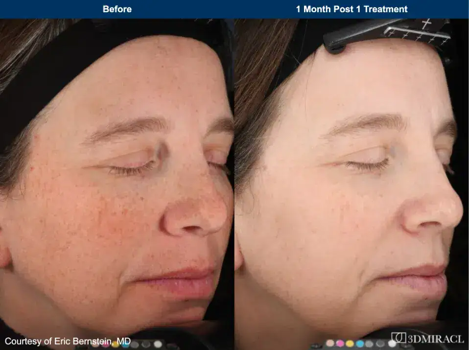 B&A 1