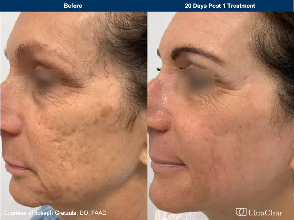 B&A 4