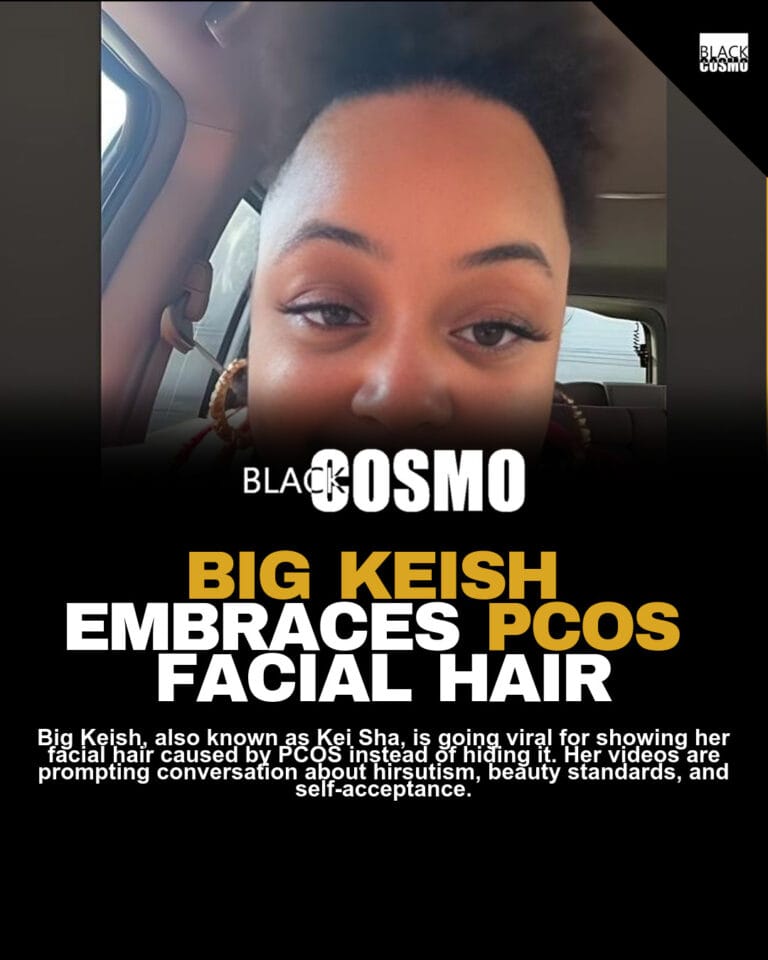 Big Keish Flaunts PCOS Beard, Goes Viral