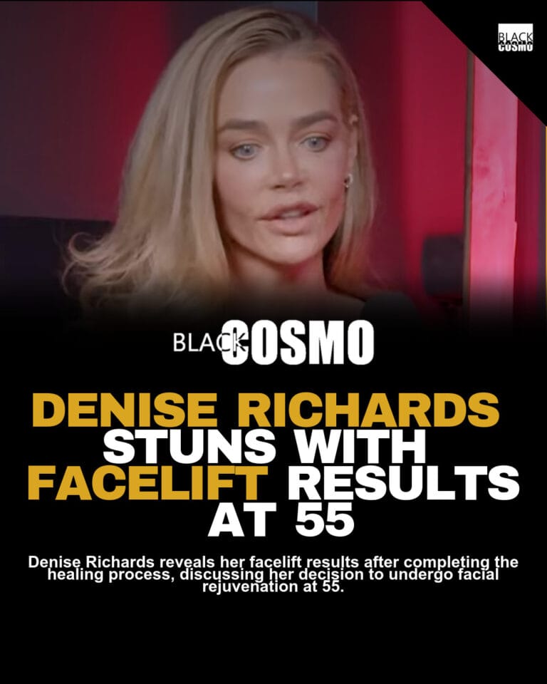 Denise Rich’s Facelift Healed – Looks 10 Years Younger