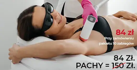 Depilacja laserowa
