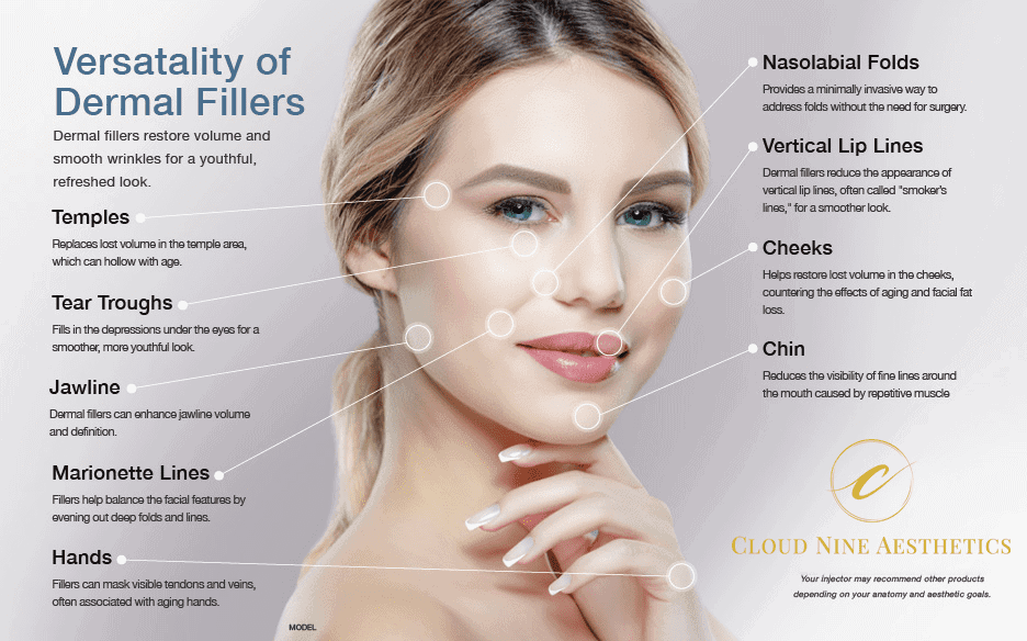 Dermal filler injection to restore facial volume and smooth lines at Cloud Nine Aesthetics in Jacksonville IL.