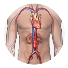 Aortic Aneurysms