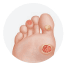 The Diabetic Foot