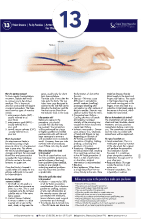 Arterio-Venous Fistula for Dialysis