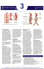 Endovascular Aortic Aneurysm Repair (EVAR)