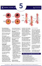 Femoral Endarterectomy