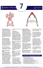 Femoral-Femoral Bypass