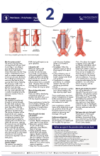 Open Abdominal Aortic Aneurysm Repair