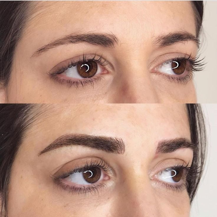 Microblading en Clínica Fontana Valencia