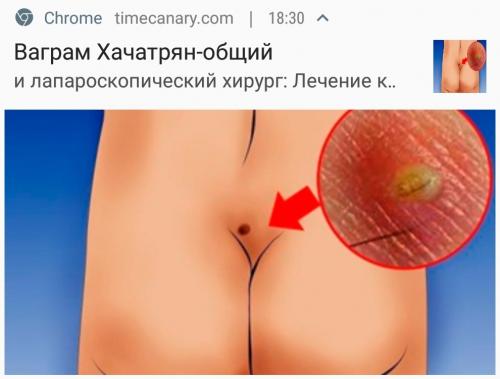 Push с прыщем