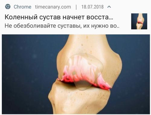Суставы