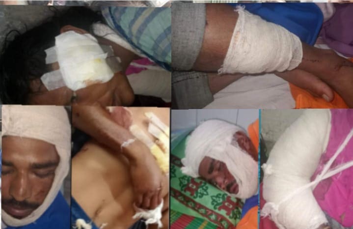 নেত্রকোনা পুর্বধল্লায় প্রতিপক্ষের হামলায় আহত ৫