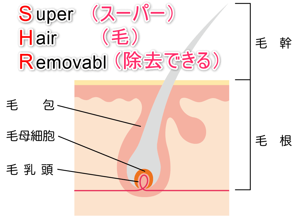 SHR脱毛の略とイラストで解説した画像