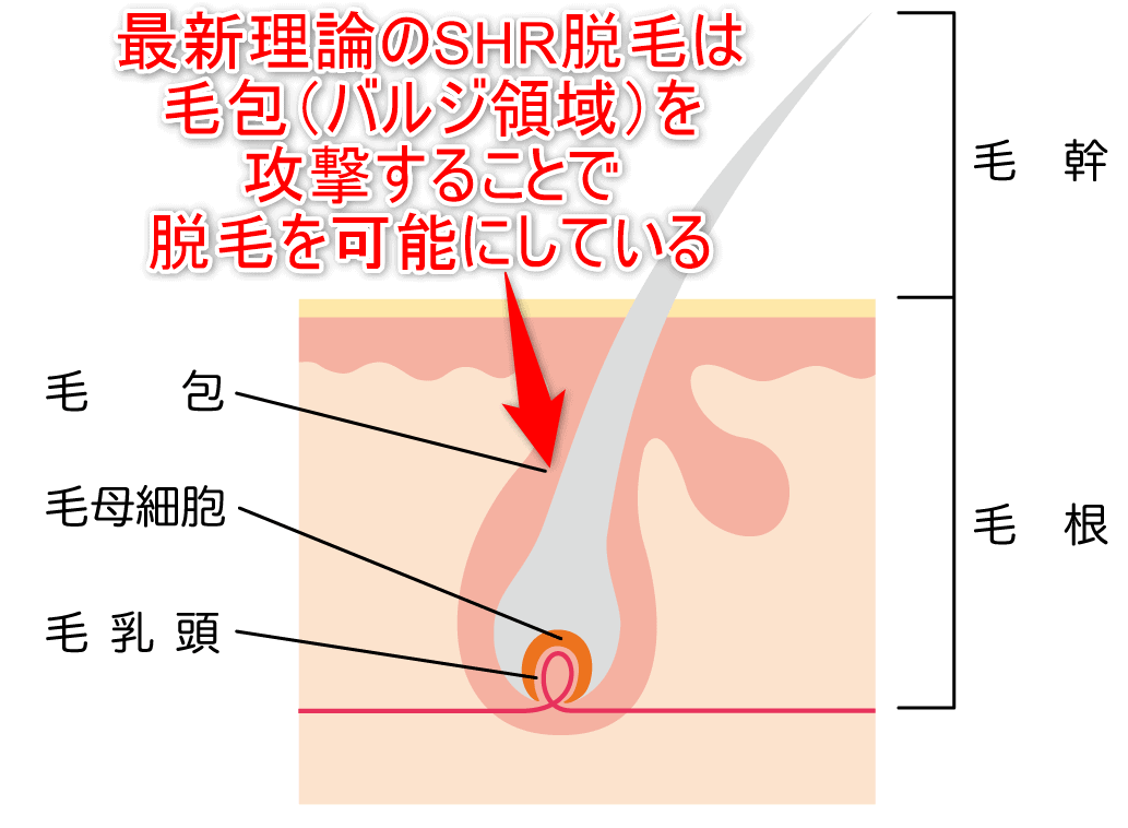最新理論のSHR脱毛は毛包（バルジ領域）までの照射で脱毛を可能にしていることを示した画像