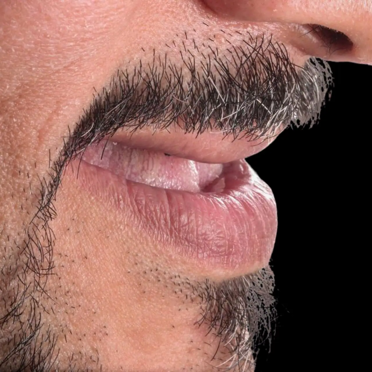 افضل دكتور زراعة اسنان