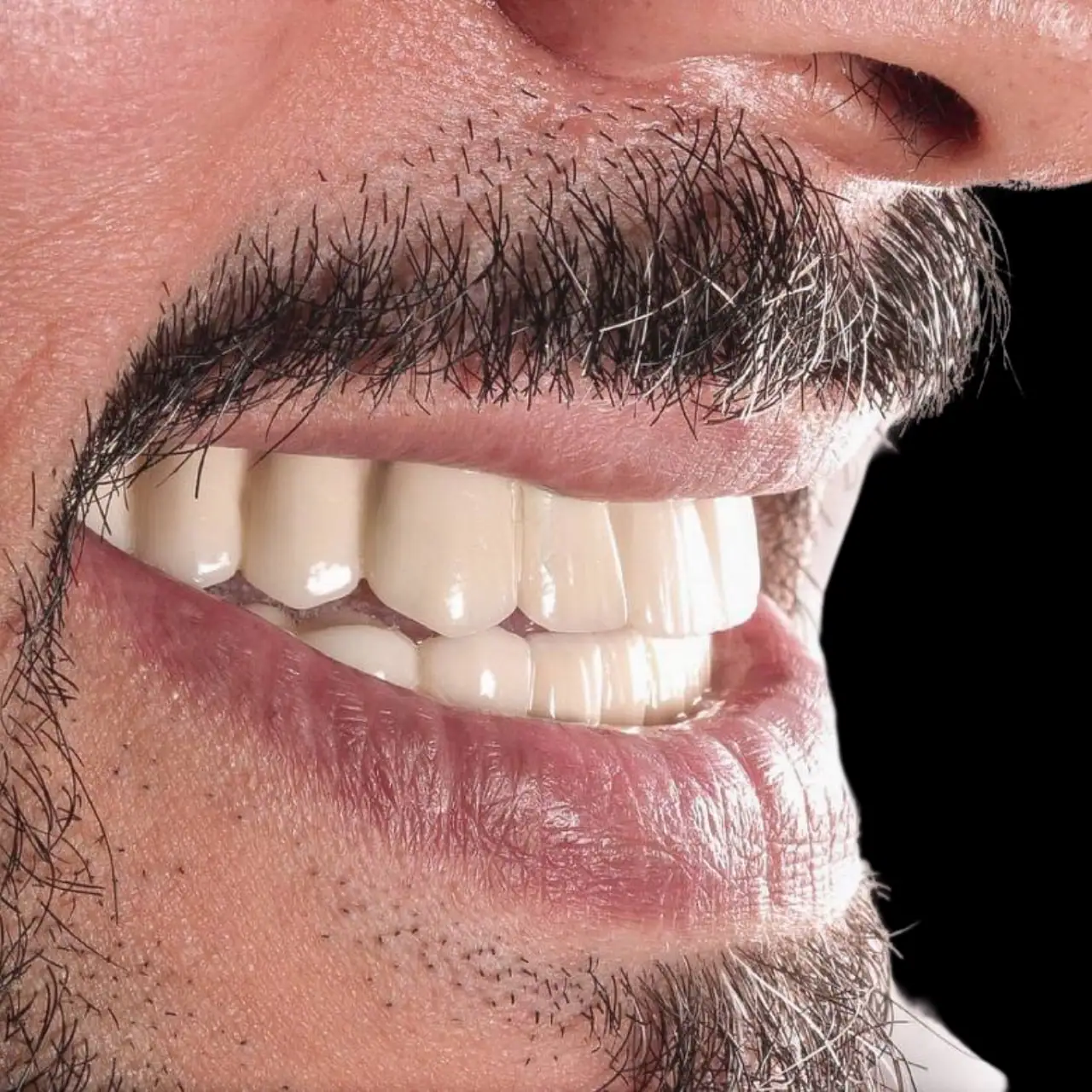 افضل دكتور زراعة اسنان