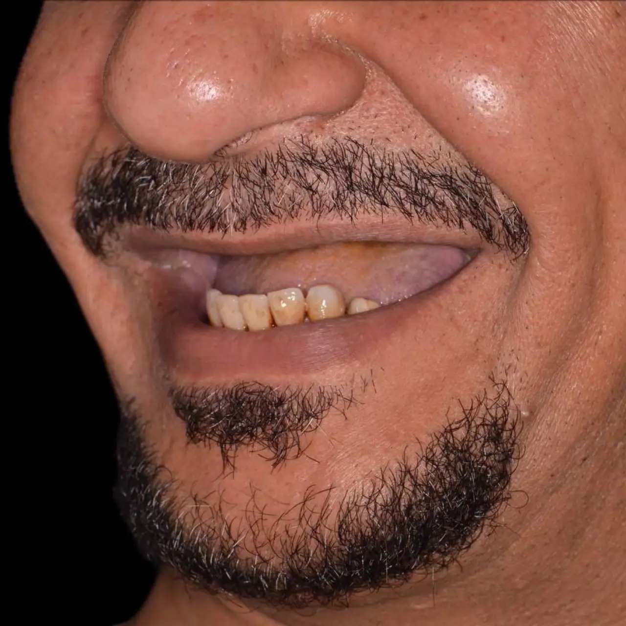 دكتور زراعة اسنان