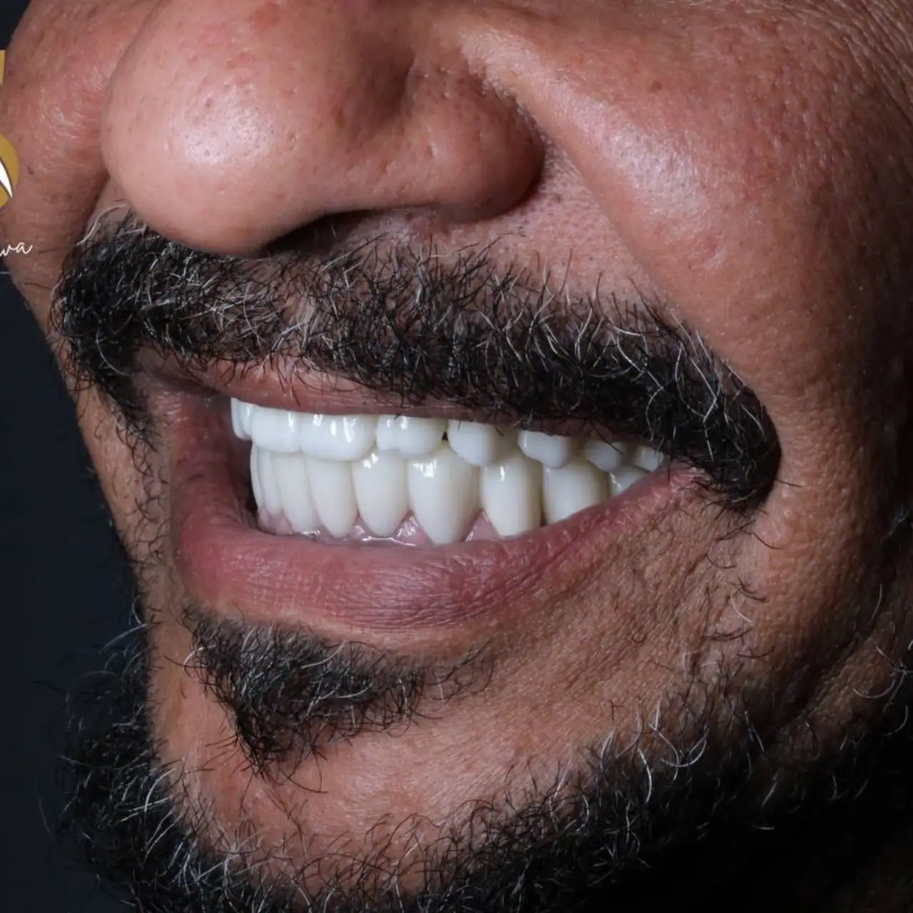 دكتور زراعة اسنان