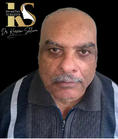 جراحات الأورام والالتهابات