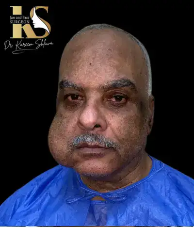 جراحات الأورام والالتهابات