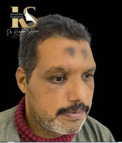 جراحات التجميل والترميم