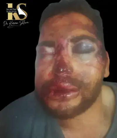 جراحات التجميل والترميم