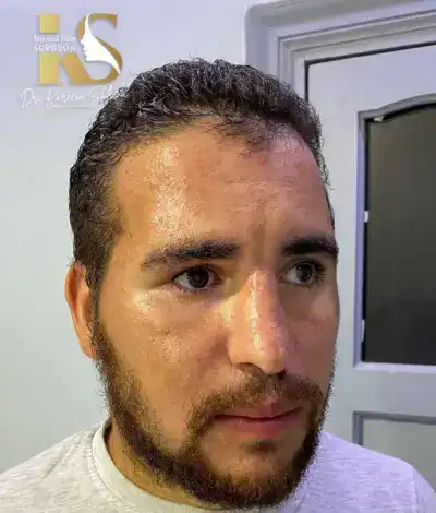 جراحة التجميل والترميم