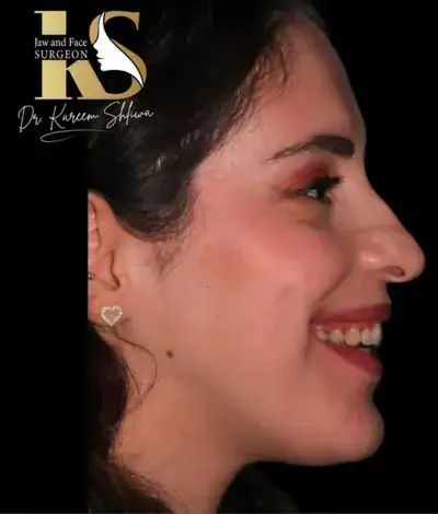 جراحة الفك التقويمية