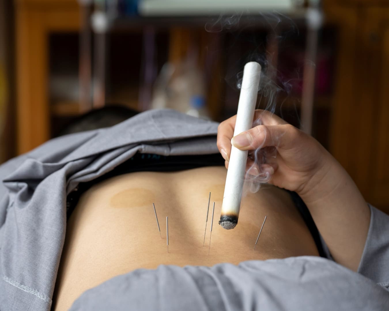 Moxabustão: A Acupuntura Térmica que Restaura o Equilíbrio do Corpo