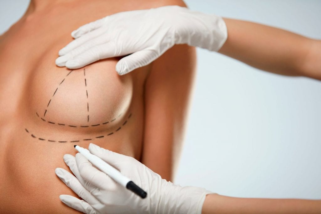 Breast Lift