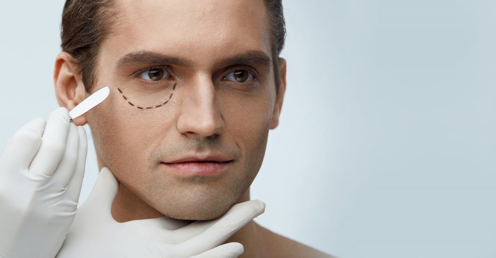 Eyelid surgery