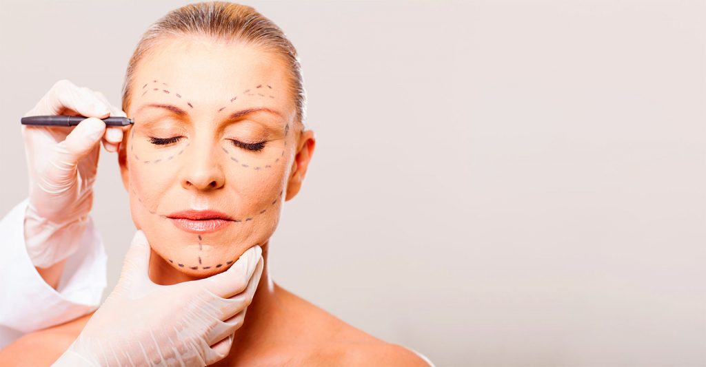 Face lift