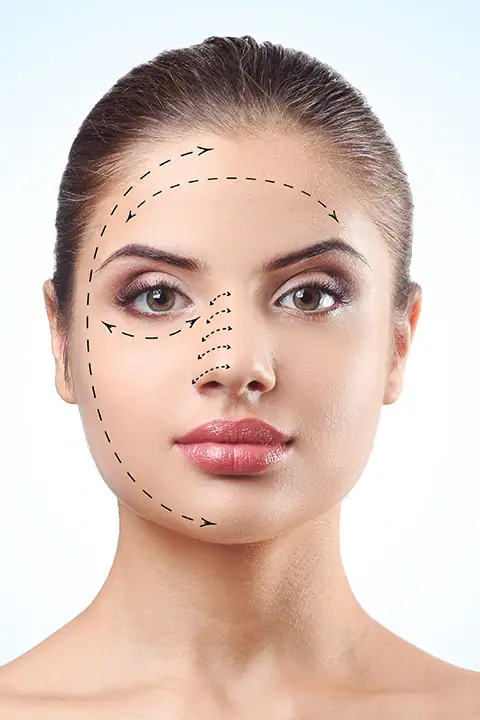 Eyelid surgery