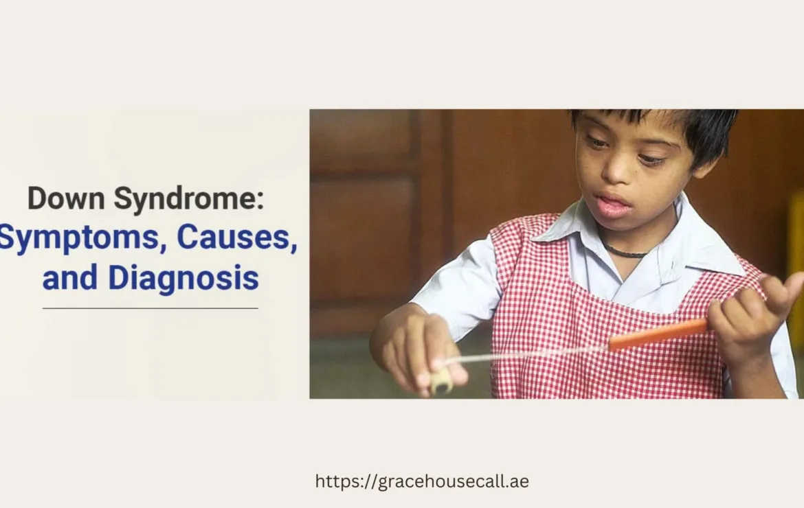 Down Syndrome, it’s types and causes!