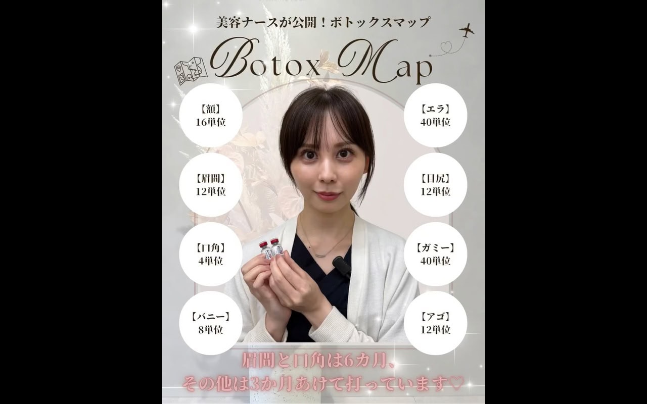 ボトックスマップを公開しましたのメイン画像
